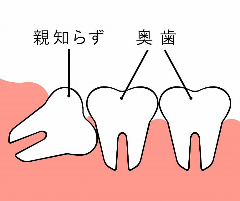 親知らず